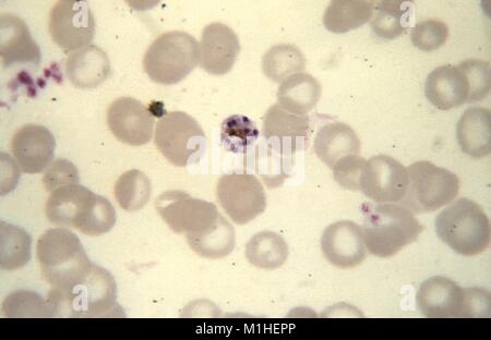 Photomicrograph des Malariaparasiten Plasmodium malariae in schizont Phase mit 10 Merozoiten, die auf dünnen Blutausstrich, 1965. Bild mit freundlicher Genehmigung von CDC/Dr. Mae Melvin. () Stockfoto