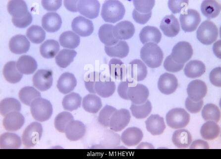 Photomicrograph des Malariaparasiten Plasmodium malariae in roten Blutzellen in Ringform, auf einer Giemsa angefärbt dünnen Blutausstrich, vergrößerte 1125 x, 1971. () Stockfoto