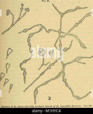 Eine praktische Abhandlung über die Krankheiten des Ohres einschließlich der Anatomie der Orgel (1880) (14594607809) Stockfoto
