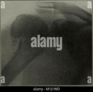 Ein Handbuch für Heilgymnastik und Massage, ausgelegt für den Einsatz von Ärzten, Studenten und Masseure (1917) (14597720018) Stockfoto