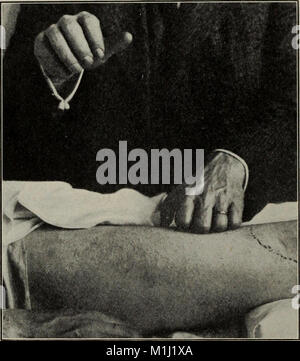 Ein Handbuch für Heilgymnastik und Massage, ausgelegt für den Einsatz von Ärzten, Studenten und Masseure (1917) (14597634090) Stockfoto