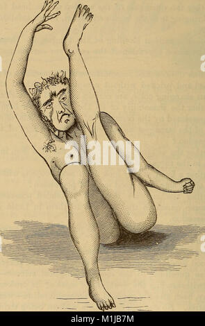 Eine Abhandlung über die Krankheiten des Nervensystems (1881) (14591188369) Stockfoto