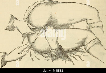 Ein System von Hebammen, einschließlich der Erkrankungen während der Schwangerschaft und der Puerperalen Zustand (1875) (14786517893) Stockfoto