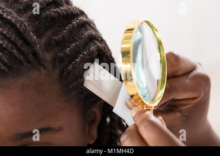 Nahaufnahme der Hautarzt suchen beim Patienten Haare durch Lupe Stockfoto