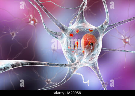 Parkinson Nervenzellen. Computer Abbildung von menschlichen Nervenzellen von Lewy Körpern (kleine rote Kugeln im Zytoplasma der Nervenzellen) im Gehirn eines Patienten mit der Parkinsonschen Krankheit betroffen. Lewy Körpern sind abnormale Ansammlungen von Protein, das in Nervenzellen bei der Parkinson-krankheit entwickeln, Lewy-Körperchen-Demenz und anderen neurologischen Erkrankungen. Stockfoto
