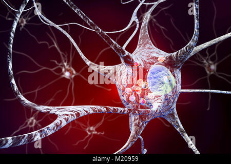 Parkinson Nervenzellen. Computer Abbildung von menschlichen Nervenzellen von Lewy Körpern (kleine rote Kugeln im Zytoplasma der Nervenzellen) im Gehirn eines Patienten mit der Parkinsonschen Krankheit betroffen. Lewy Körpern sind abnormale Ansammlungen von Protein, das in Nervenzellen bei der Parkinson-krankheit entwickeln, Lewy-Körperchen-Demenz und anderen neurologischen Erkrankungen. Stockfoto