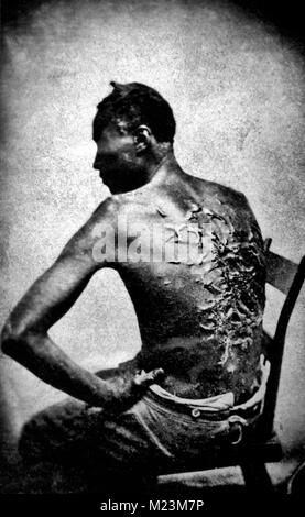 Narben eines Schlagsahne Mississippi Slave, Foto April 2, 1863, Baton Rouge, Louisiana, USA. Stockfoto