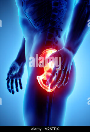 3D Illustration, Hüfte schmerzhaft Skelett Röntgen, medizinisches Konzept. Stockfoto