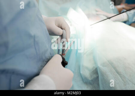 Arzt und Hilfe medizinische Team bei Operationen auf einem Patienten in Betrieb. Instrumente für die Laparoskopie. Chirurgen, die im Krankenhaus oder in der Cl Stockfoto
