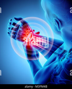 Handgelenk schmerzhaft - Skelett Röntgen, 3D Illustration medizinisches Konzept. Stockfoto