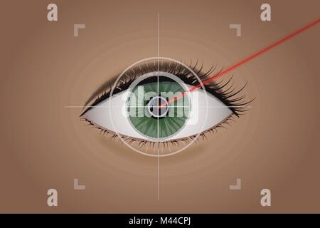 Vision Korrektur durch einen Laserstrahl. Stock Vektor