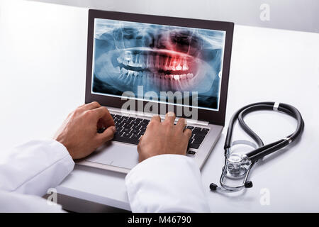 In der Nähe von einem Zahnarzt Hand Tippen auf Laptop mit Dental X-ray auf dem Bildschirm Stockfoto