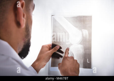 Nahaufnahme eines jungen männlichen Arzt untersuchen Knie X-ray Stockfoto