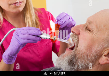 Zahnmedizinische Polymerisation mit UV-Lampe auf älteren männlichen Patienten Stockfoto