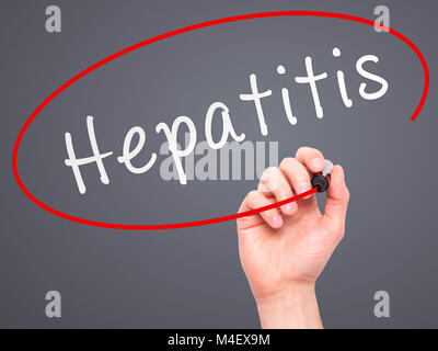 Hand Hepatitis schreiben mit Marker auf Transparenten abwischen Board Stockfoto