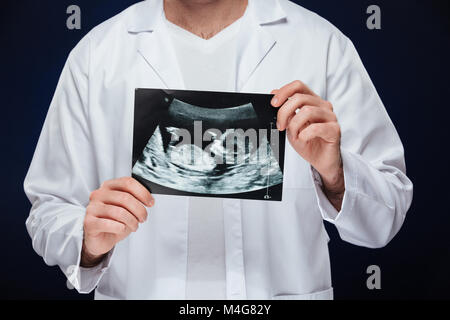 Nahaufnahme von einem männlichen Arzt in Uniform gekleidet, Baby x-ray über dunklen Hintergrund isoliert Stockfoto