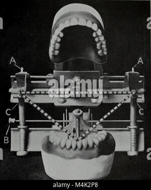 Artikulator; Die zahnmedizinische Kosmos (1914) Stockfoto