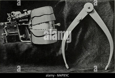 Biss-gage; Die zahnmedizinische Kosmos (1914) Stockfoto