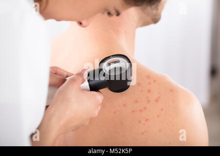 Weibliche Dermatologen untersuchen Acnes des Patienten mit Dermatoskop Stockfoto