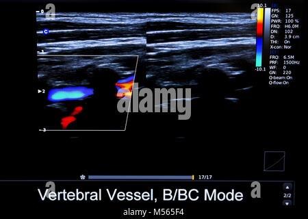 Bunte Bild von Ultraschall monitor Stockfoto