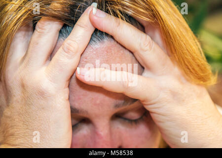 Miami Florida, Erwachsene Erwachsene Frau Frauen weibliche Dame, Ruhe, Hand, Hände, Kopfschmerzen, Anspannung, Kopf, Haare, Augen geschlossen, Besucher reisen Reise Tour Tourist zu Stockfoto