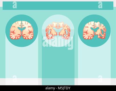Hintergrund Vorlage mit menschlichen Gehirnen Abbildung Stock Vektor