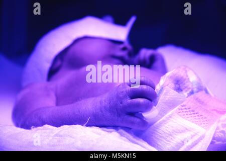 Die Behandlung eines Babys mit Gelbsucht des Neugeborenen im Krankenhaus Stockfoto