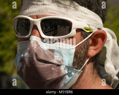 Closeup jungen männlichen Arzt tragen Medizin Maske Blut befleckt Stockfoto