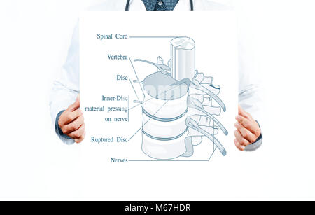 Medizin und Anatomie. Arzt und anatomische Wirbelsäule. Facettengelenke Stockfoto