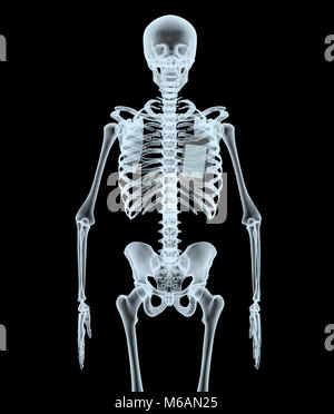 Skelett X-Ray Smartphone anzeigen. 3 Abbildung d auf einem schwarzen Hintergrund isoliert Stockfoto