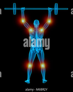 Sehr ausführliche und medizinisch genaue 3D-Illustration einer transluzenten Mann Gewichte zu heben, während mit Schmerz in seiner Gelenke Stockfoto