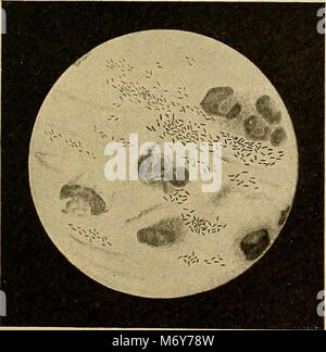 "Diagnostische Methoden, chemische, bakteriologische und mikroskopischen: ein Lehrbuch für Studierende und Praktiker" (1909) Stockfoto