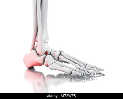 3D-Darstellung. Schmerzhafte Knöchel auf weißem Hintergrund. Medizin Konzept. Stockfoto