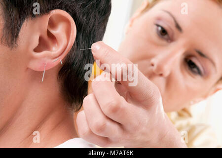 Akupunkteur, die Anwendung von Nadeln am Ohr eines Mannes Stockfoto