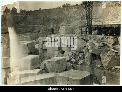 Steinbruch Szenen. Es wurden keine Kinder beschäftigt. LOC 05109 nclc. Stockfoto