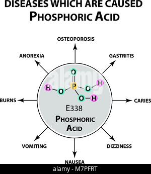Krankheiten, Orthophosphorsäure verursachen. Die chemische Formel von Phosphorsäure. Infografiken. Vector Illustration auf isolierte Hintergrund. Stock Vektor