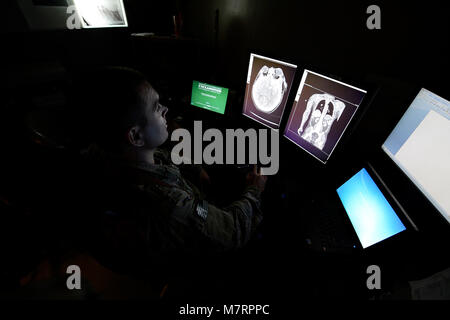 Us Air Force Maj. Shane Newberry, 455Th Expeditionary Medizinischer Support Squadron stellvertretender flight Commander, Bewertungen des Patienten Röntgenbilder am Flughafen Bagram, Afghanistan, 24. Juli 2014. Radiologen an der Craig gemeinsame Theater Krankenhaus sind verantwortlich für die Bereitstellung einer Vielzahl von Imaging Expertise wie Röntgen, Ultraschall, und Durchleuchtung für die Patienten. Newberry ist von Joint Base San Antonio, Texas und ein Eingeborener von Las Vegas, Nev (USA bereitgestellt Air Force Foto: Staff Sgt. Evelyn Chavez/Freigegeben) 455th Air Expeditionary Wing Flughafen Bagram, Afghanistan Stockfoto