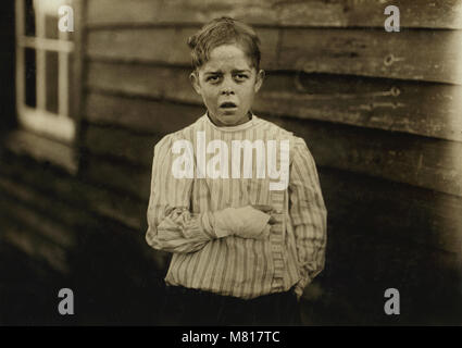 Giles Edmund Newsom, Junge Cotton Mill Worker, 12 Jahre alt, fielen auf die Spinnmaschine und seine Hand fuhr in ungeschützten Gearing, verloren, zwei Finger, Brustbild, Sanders Spinnerei, Bessemer City, North Carolina, USA, Lewis Hine für nationale Kinderarbeit Ausschuss, Oktober 1912 Stockfoto