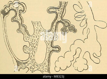 Klinischen Vorlesungen über die Grundsätze und die Praxis der Medizin (1874) (14803584843) Stockfoto