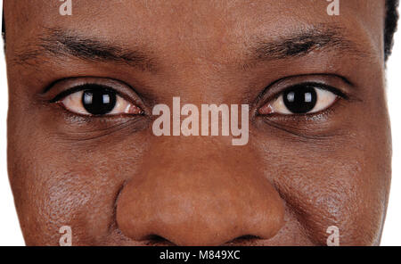 Die großen Augen eines afrikanischen amerikanischen Mann in einer Nahaufnahme Bild, suchen Straße in die Kamera, auf weißem Hintergrund Stockfoto