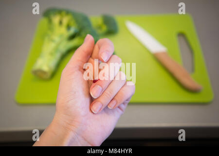 Verletzte Finger mit Blut und Messer auf Schneidebrett mit Brokkoli Stockfoto