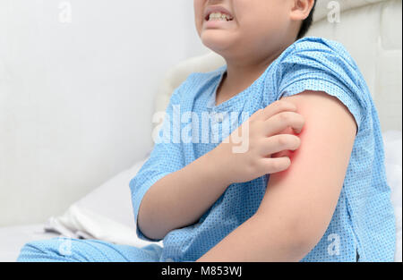 Beleibte Fat Boy scratch die Krätze mit Hand, Konzept mit Gesundheitswesen und Medizin. Stockfoto