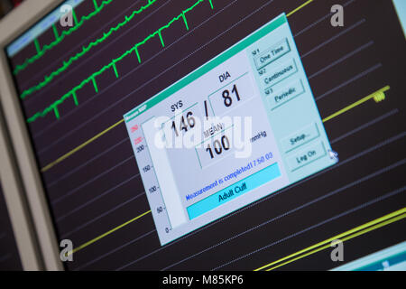 Blutdruck, Herzfrequenz überwachen Stockfoto