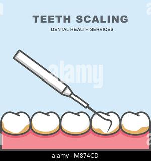 Zahn Skalierung icon-Reihe von Zahn, Reinigung mit Parodontalen Sonde Stock Vektor