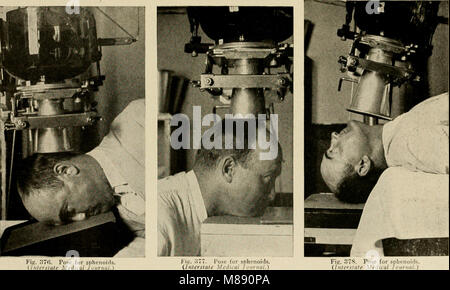 Elementare und zahnmedizinische Radiographie - von Howard Riley Raper (1918) (14758415795) Stockfoto