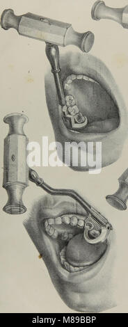 Extraktionen-3; die Anatomie, Physiologie und Pathologie des menschlichen Zähnen (1844). Stockfoto