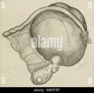 Allgemeine und zahnmedizinischen Pathologie mit besonderer Berücksichtigung der Ätiologie und der pathologischen Anatomie; eine Abhandlung für Studenten und Praktiker (1920) (14595872430) Stockfoto