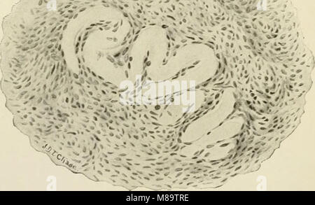 Allgemeine und zahnmedizinischen Pathologie mit besonderer Berücksichtigung der Ätiologie und der pathologischen Anatomie; eine Abhandlung für Studenten und Praktiker (1920) (14780202554) Stockfoto