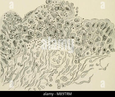 Allgemeine und zahnmedizinischen Pathologie mit besonderer Berücksichtigung der Ätiologie und der pathologischen Anatomie; eine Abhandlung für Studenten und Praktiker (1920) (14802442783) Stockfoto