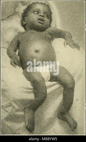 Krankheiten der Kinder (1916) (14766199405) Stockfoto